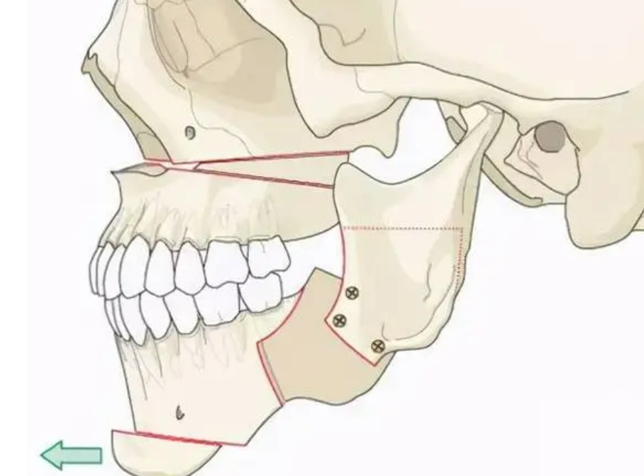 image.png image.png