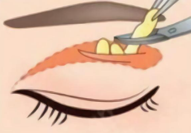 image.png image.png