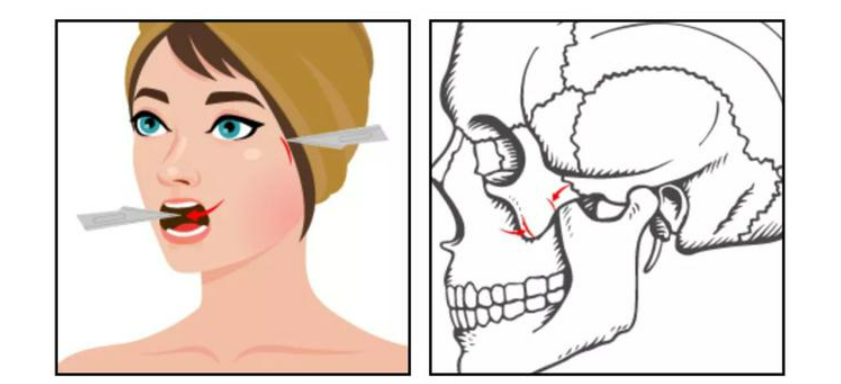 image.png image.png