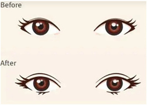 眼睛17.jpg