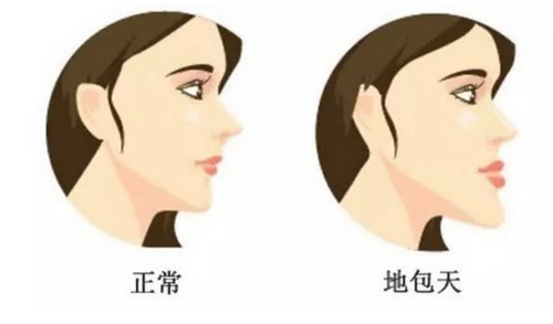 深圳青逸植发效果好吗？优质头发种植医院概况+体验感受参考