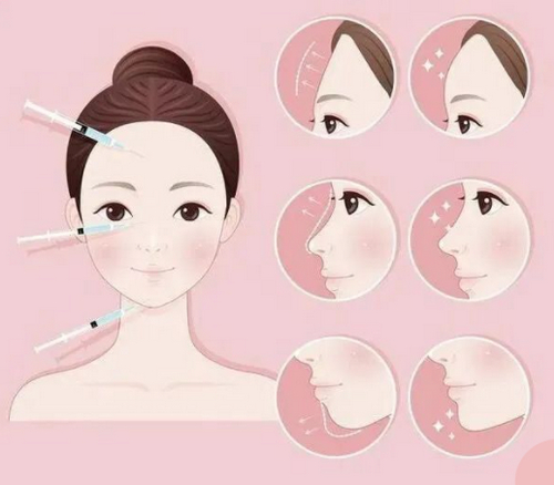 成都艺星医疗美容医院做脂肪填充可靠吗？真实案例效果抓紧参考