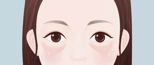 成都华美紫馨外切祛眼袋怎么样？术后效果\医院环境点击查看