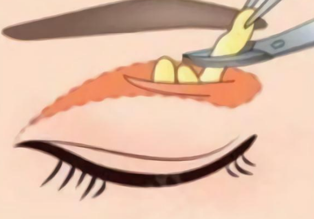image.png image.png