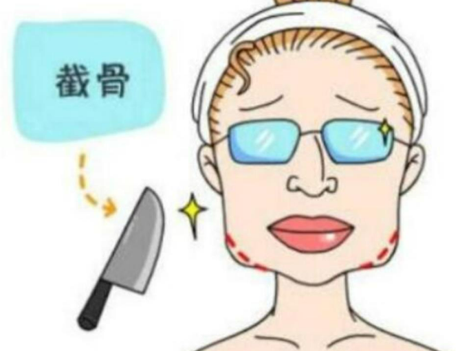 北京华韩医疗美容医院怎么样，术后案例分享，医院口碑测评