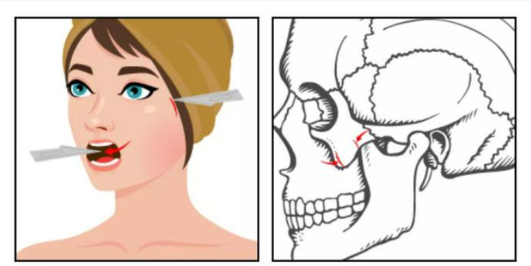 image.png image.png