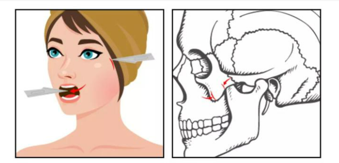 image.png image.png