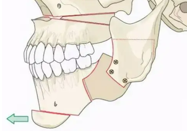 image.png image.png