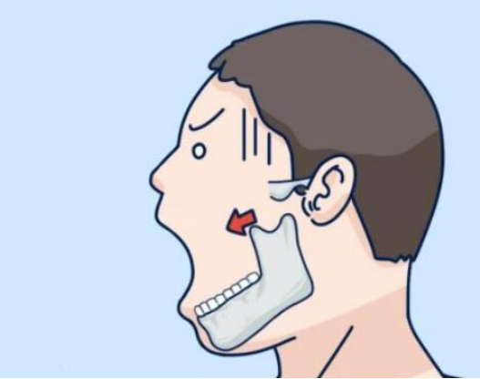 image.png image.png