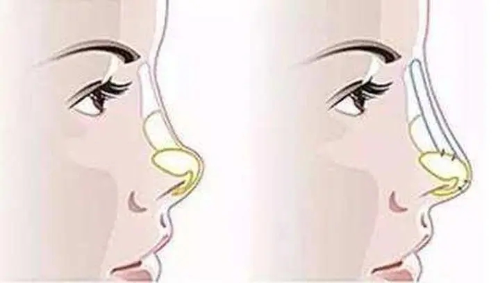 u=3931595786,2965486775&fm=253&fmt=auto&app=138&f=JPEG.webp.jpg u=3931595786,2965486775&fm=253&fmt=auto&app=138&f=JPEG.webp.jpg