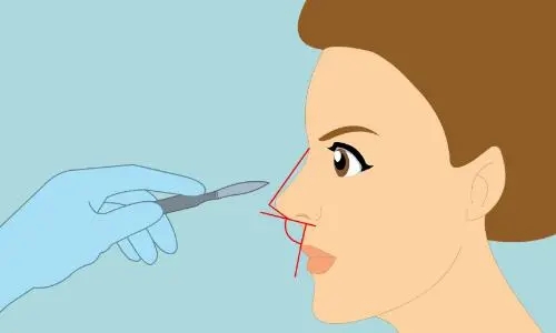 u=3643264536,1588113340&fm=253&fmt=auto&app=138&f=JPEG.webp.jpg u=3643264536,1588113340&fm=253&fmt=auto&app=138&f=JPEG.webp.jpg