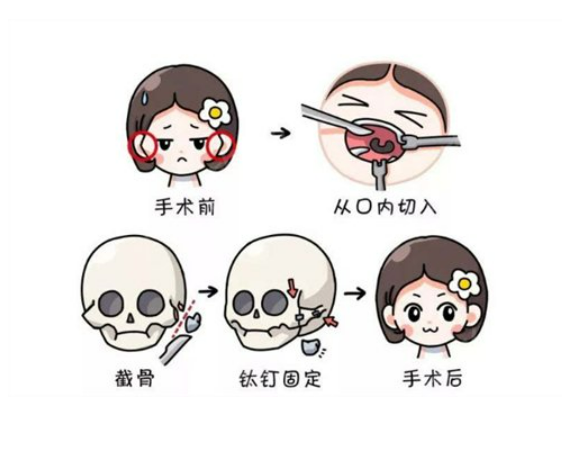image.png image.png