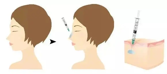 u=3967769302,3619876439&fm=253&fmt=auto&app=138&f=JPEG.webp.jpg u=3967769302,3619876439&fm=253&fmt=auto&app=138&f=JPEG.webp.jpg