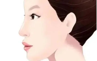 u=1722041349,300715139&fm=253&fmt=auto&app=138&f=JPEG.webp.jpg u=1722041349,300715139&fm=253&fmt=auto&app=138&f=JPEG.webp.jpg
