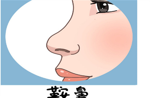 河南中医药大学第一附属医院整形美容科隆鼻案例分享，医院简介，戳进来了解