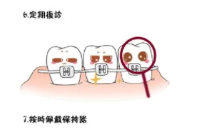 牙齿矫正20.png