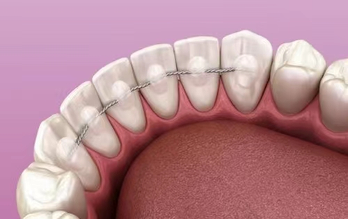 1354889599.jpg 1354889599.jpg