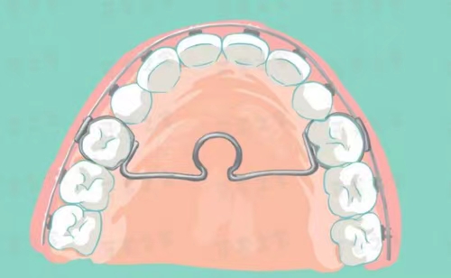 7103852.jpg 7103852.jpg