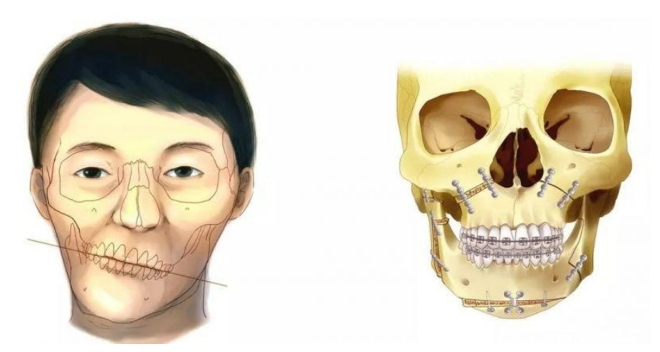 image.png image.png