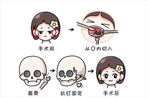 广州可玉医疗美容门诊部怎么样？价格表更新！口碑反馈get~