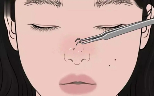 株洲爱思特医疗美容中心怎么样？简介资料提前看，附上隆鼻案例