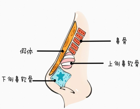 合肥做隆鼻价格多少？医院名单在线更新，隆鼻价格5000元起