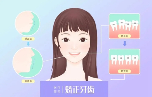 泰安市岱岳区妇幼保健院口腔科怎么样？价格表更新！医生口碑反馈get~