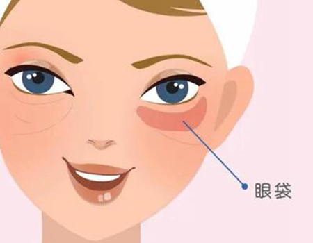 武汉做眼袋手术价格多少？价格咨询和医院信息盘点