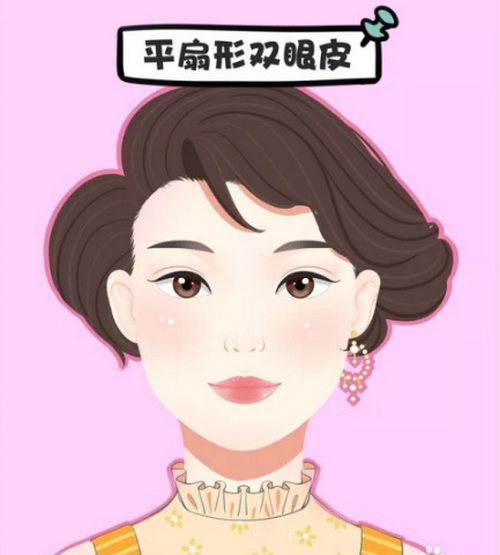 重庆市第六人民医院整形美容外科做双眼皮怎么样?案例效果分享