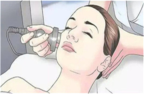 激光5.jpg