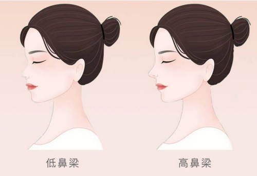 上海五官科医院眼耳鼻整形外科怎么样？医院介绍及隆鼻案例分享