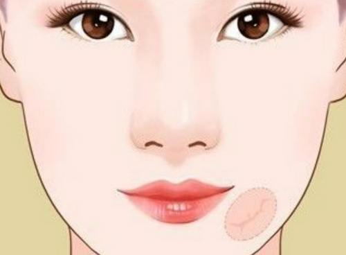 甘肃省干部医疗保健院烧伤整形科祛疤技术怎么样？疤痕修复术后图分享