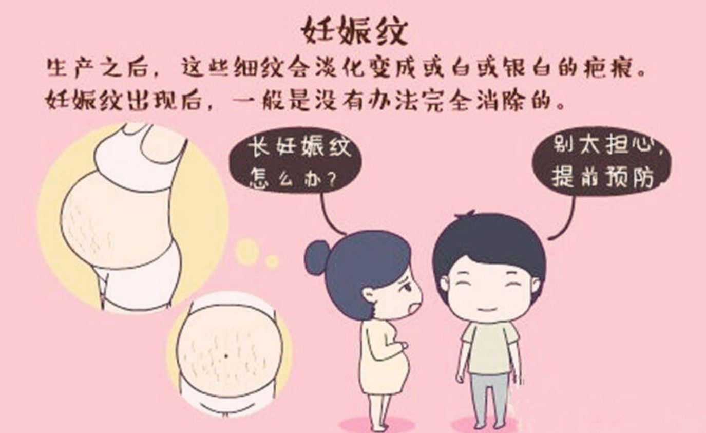 激光改良妊娠纹3.png