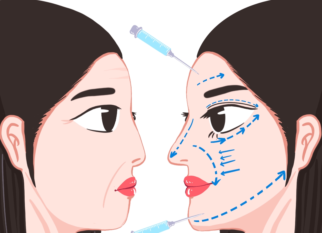 面部轮廓重塑2.png 面部轮廓重塑2.png