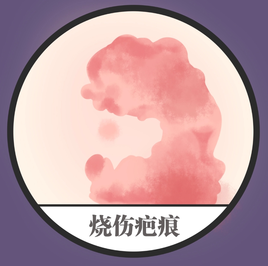 烟台市烟台山医院烧伤整形外科疤痕手术怎么样？费用价格明细和真人案例