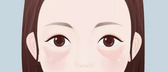 新乡医学院三附院医疗美容科去眼袋手术怎么样？案例效果前后对比