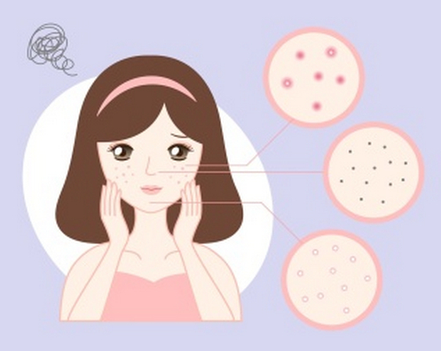 沈阳七院美容科点雀斑多少钱？费用标准参考，查看案例效果