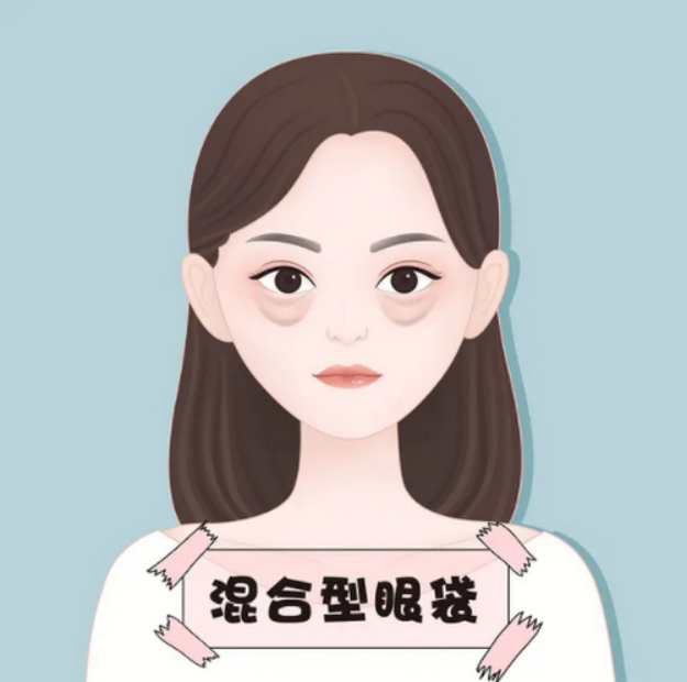 常州去眼袋手术费用大概多少钱?为你推荐三家优秀的整形医院