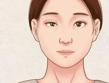 廊坊做双眼皮价格是多少？人气评价高的医院分享