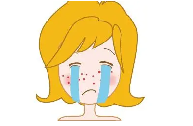 广州军区总医院激光去痘坑要多少钱？让你的皮肤重焕新生,附案例