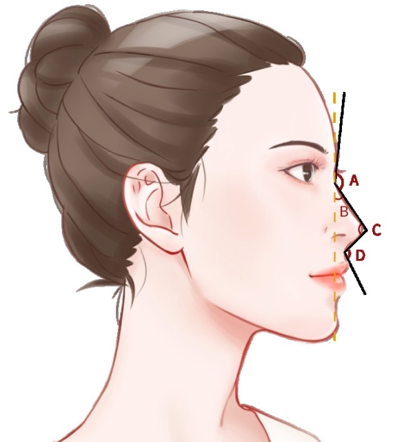 西安乔雅登玻尿酸打鼻子多少钱？更新实力靠前的医美医院介绍
