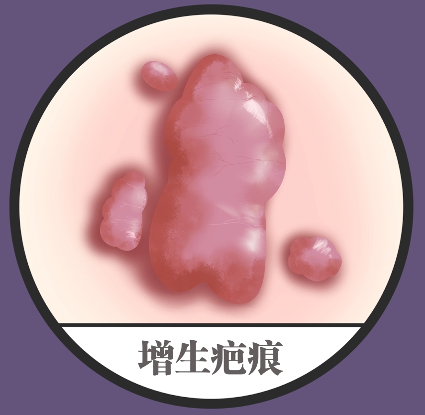 内蒙古自治区人民医院整形烧伤外科烧伤修复好不好？价格表和医院信息速来了解