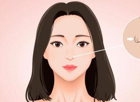 济南玻尿酸填充多少钱？优选口碑好的医美医院供参考