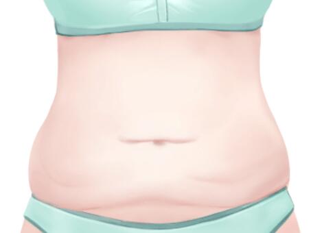 常州腹部抽脂肪要多少钱？优选实力医美医院