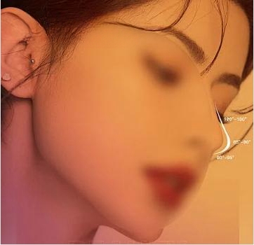 宁波硅胶隆鼻大概多少钱？含人气医美医院前三名