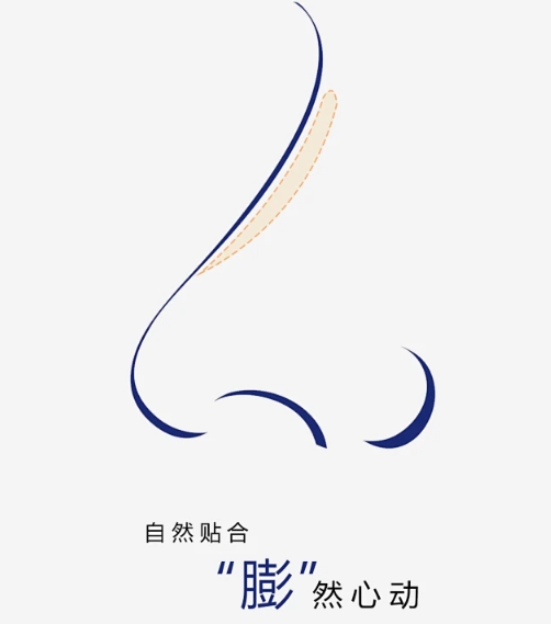 全国膨体隆鼻手术需要多少钱？盘点三家医美医院来了