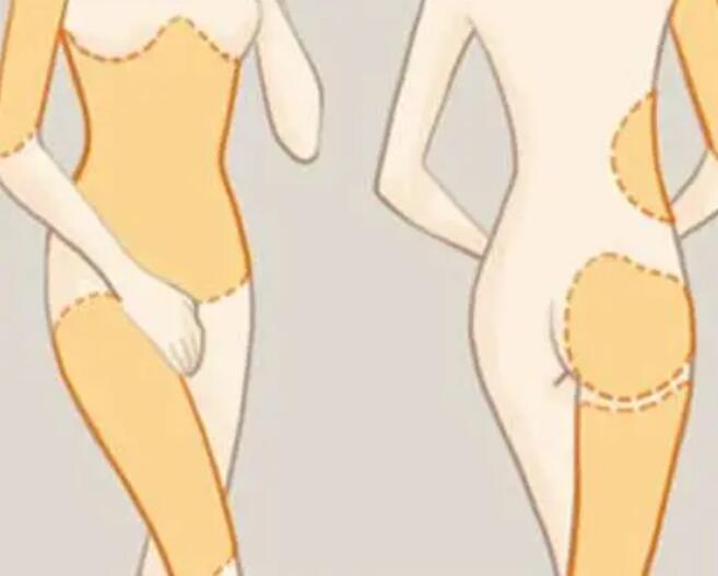 哈尔滨大腿抽脂多少钱？口碑人气带你详细了解