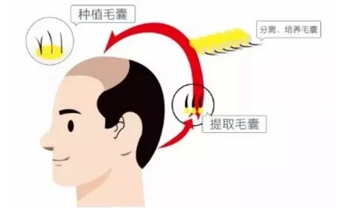 杭州植发整形2024价格参考，3家实力医院信息分享