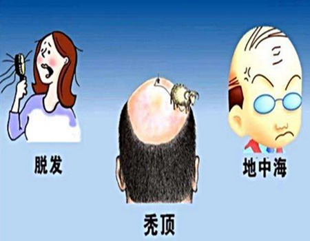 福州植发怎么收费？详细了解上榜实力医院有哪些