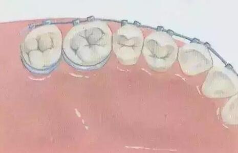 天津矫正牙齿价格是多少？精选top3机构名单